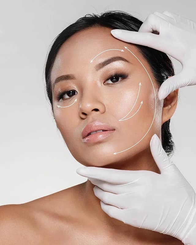 cosmetic-thread-lift